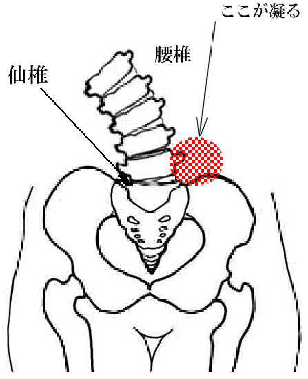骨盤イラスト